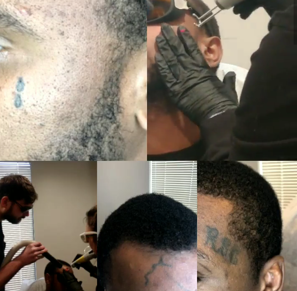 Face-tattoo-cover-up